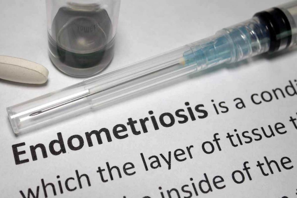 cos'è l'endometriosi